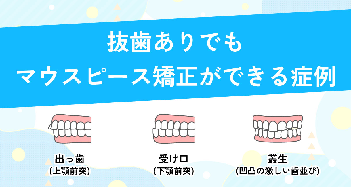 抜歯が必要でもマウスピース矯正はできる？