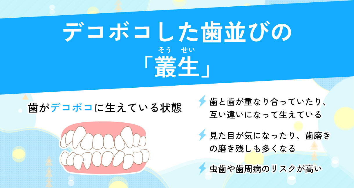 正常な歯並びの特徴は？