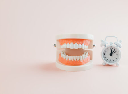 マウスピース矯正の治療期間はどのくらい？平均期間と長引く原因を解説