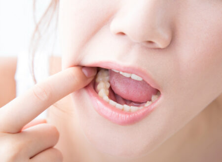 歯列矯正中にできる口内炎の原因は？対処法・予防法も併せて解説