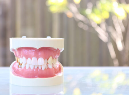 歯がガタガタしているのはなぜ？原因や歯並びを治す矯正方法も解説