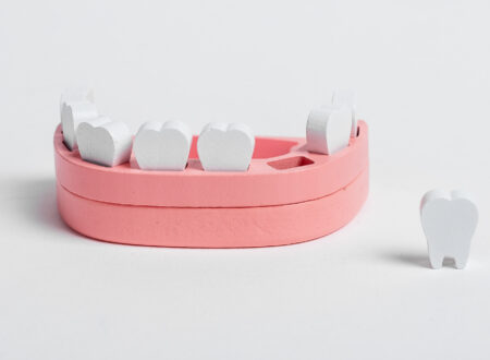 八重歯が抜けた！放置は危険？緊急時の応急処置と治療の選択