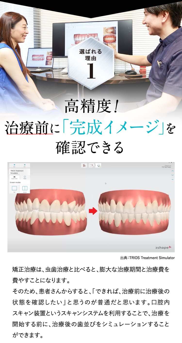 高精度！治療前に「完成イメージ」を確認できる