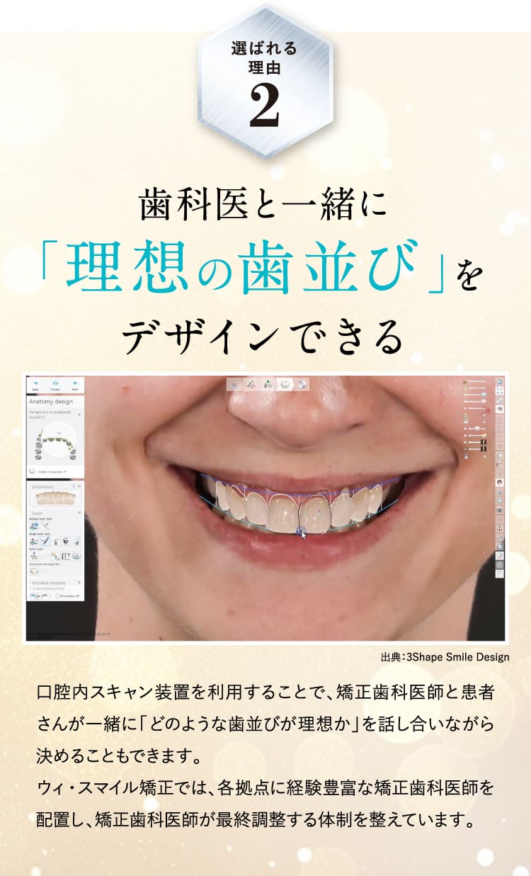 歯科医と一緒に「理想の歯並び」をデザインできる