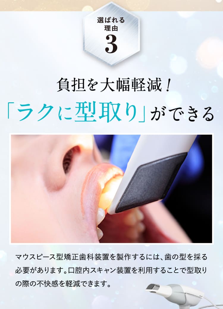 負担を大幅軽減！「ラクに型取り」ができる