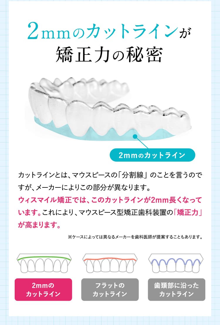 2mmのカットラインが矯正力の秘密