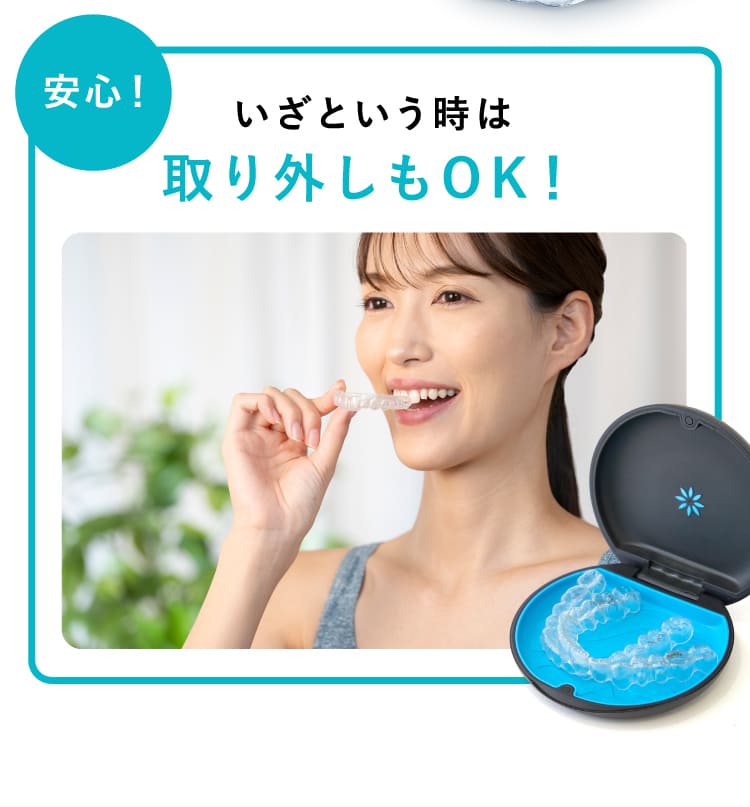 いざという時は取り外しもOK！