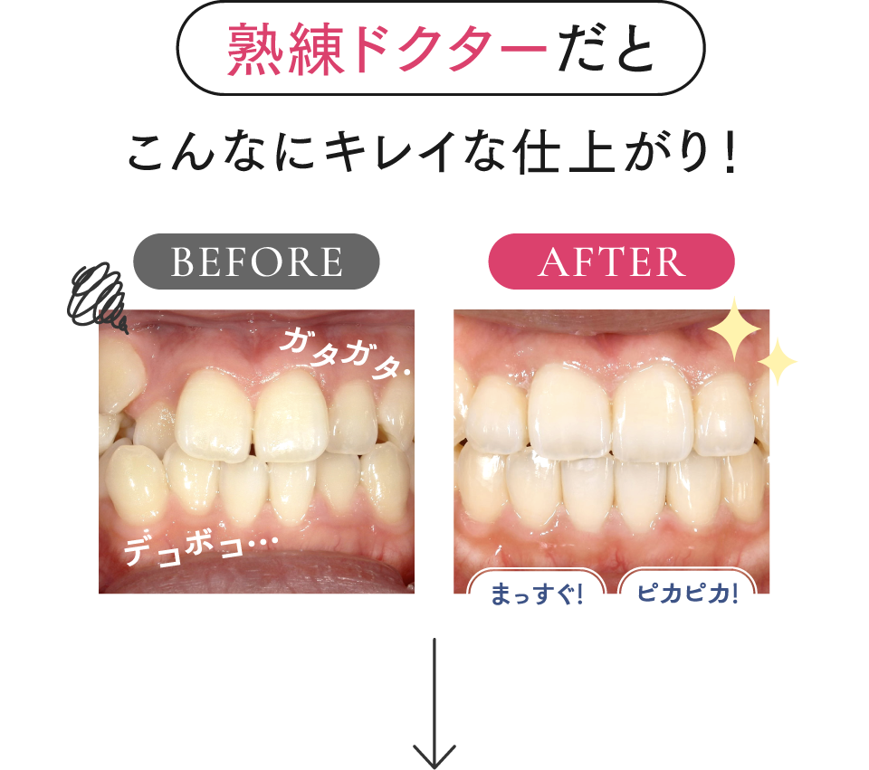 熟練ドクターだとこんなにキレイな仕上がり！