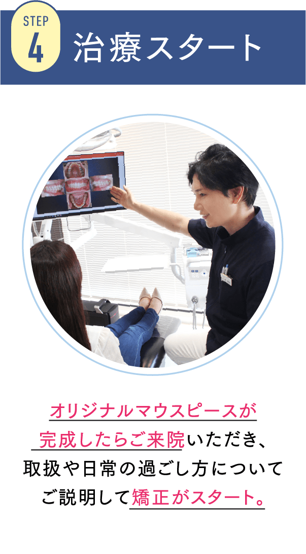 STEP4 治療スタート オリジナルマウスピースが完成したらご来院いただき、取扱や日常の過ごし方についてご説明して矯正がスタート。