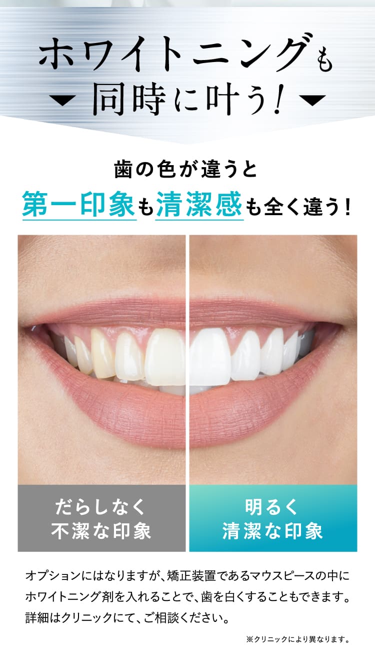 ホワイトニングも同時に叶う！