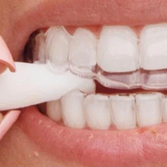 インビザラインの隙間は大丈夫？浮き・埋まらない原因と正しい対処法