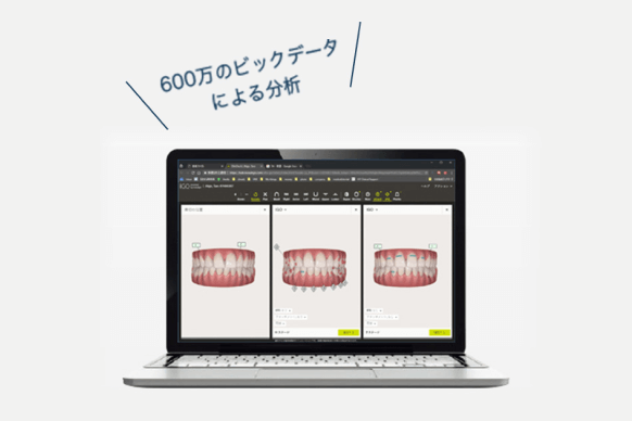 「AI機能」で治療計画を立案