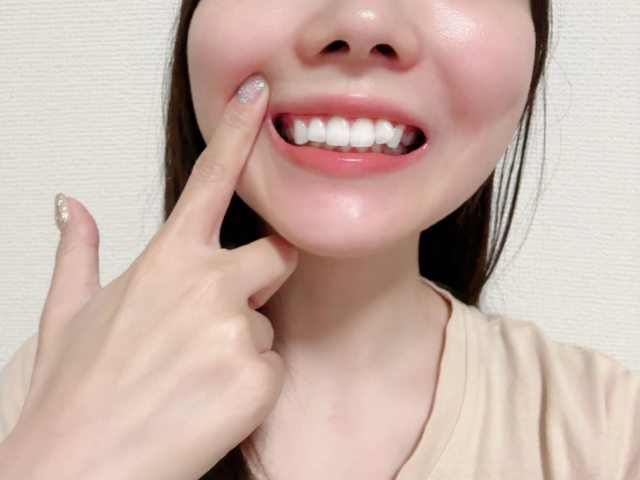 非抜歯矯正で出っ歯になった？考えられる原因と後悔しないための対処法