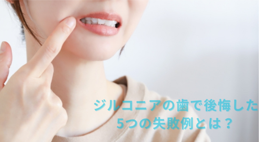 ジルコニアの歯で後悔した5つの失敗例｜見た目・噛み合わせ・費用で損しないための対策