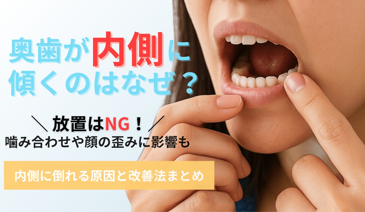 奥歯が内側に傾いている原因と治し方｜放置リスクと矯正での改善法を解説