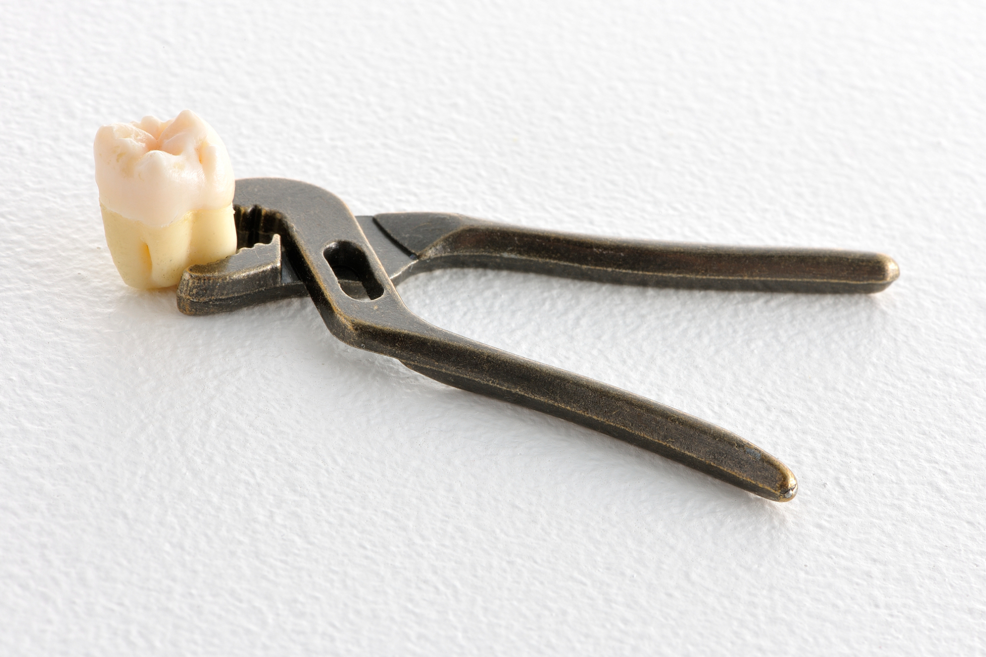 親知らずがあっても歯列矯正できる？抜歯が必要・不要なケースを解説