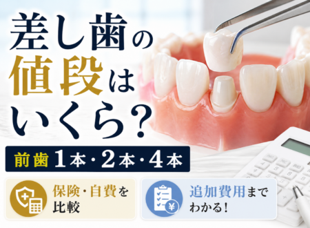 差し歯の値段はいくら？前歯1本・2本・4本の費用を保険・自費別に解説