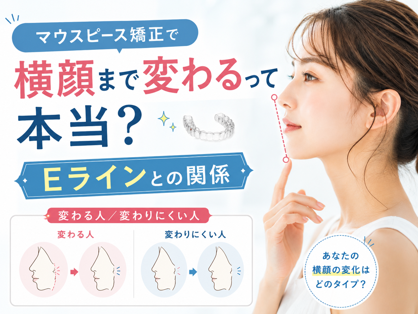 マウスピース矯正で横顔は変化する？Eラインが整う人の特徴と注意点