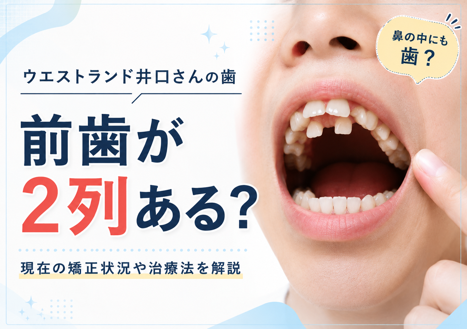 「前歯が二列ある」ウエストランド井口の歯｜矯正状況と治療法を解説